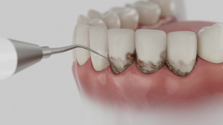 Trusted Teeth Cleaning And Checkup service in Fulton, KY - Dentist Open Now